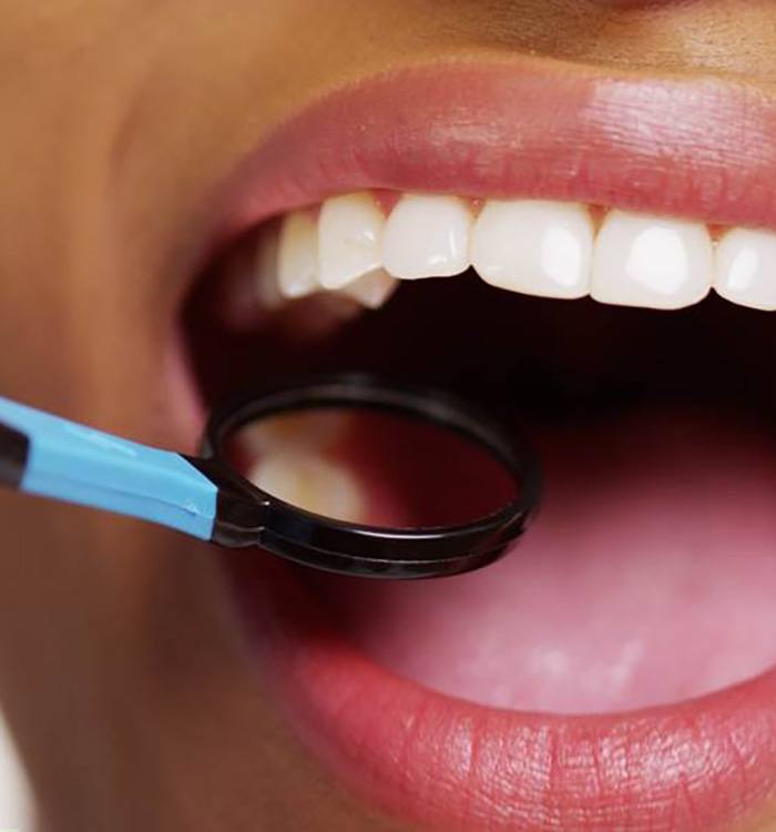 Closeup of dental mirror in mouth examining teeth