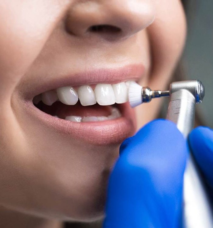 Closeup of a beautiful smile getting polished by a dentist
