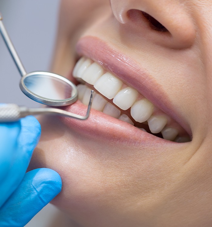 Closeup of smile during dental treatment