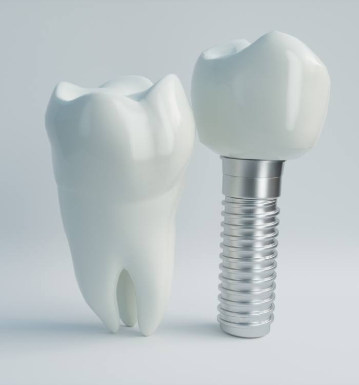 Animated natural tooth and dental implant