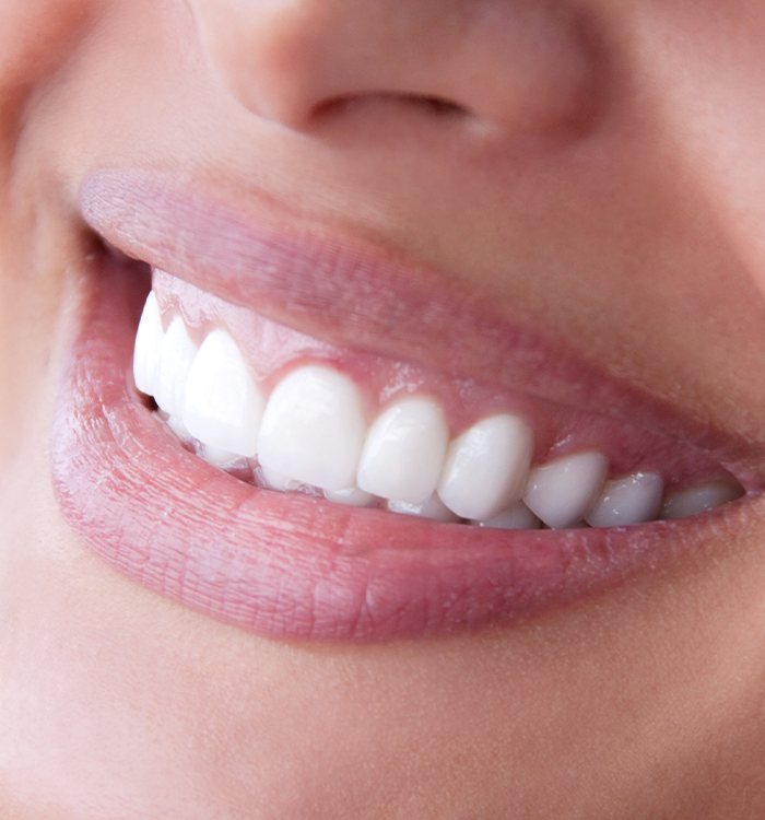 Patient's healthy smile after fluoride treatment