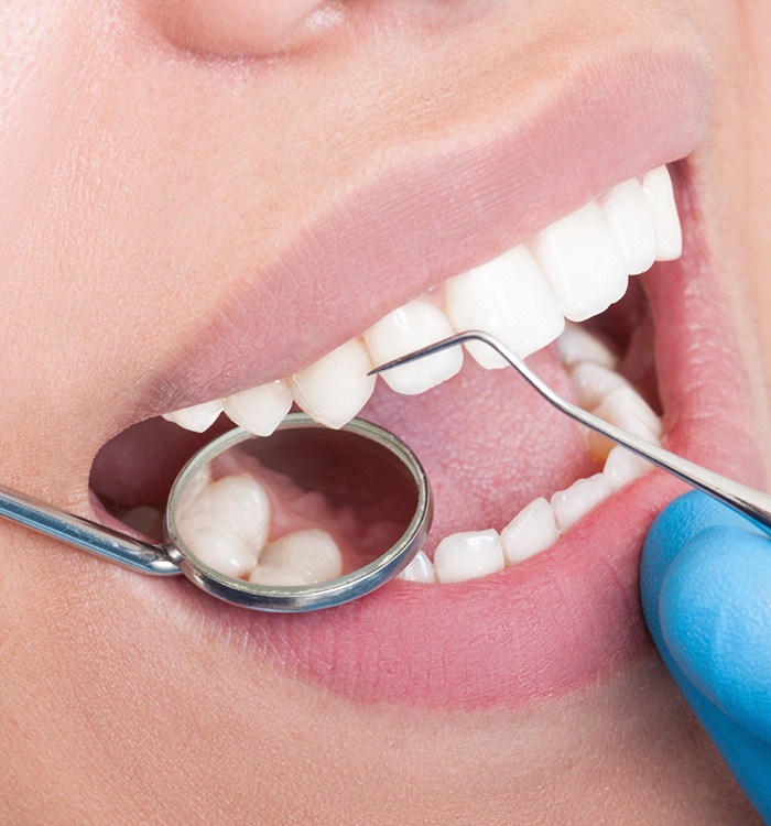 Dentist checking patient's dental work