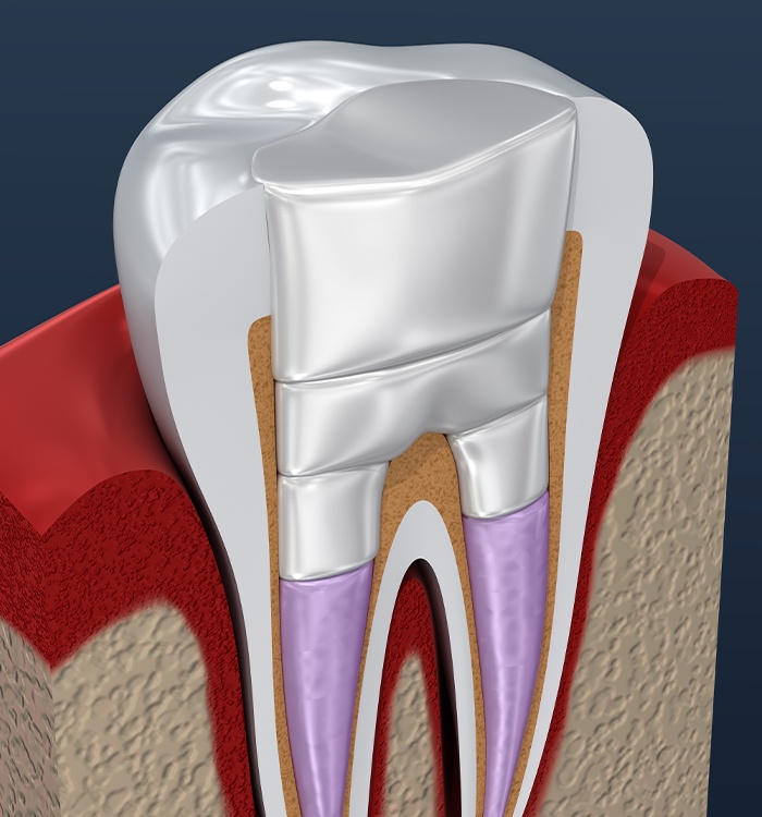 Animated tooth