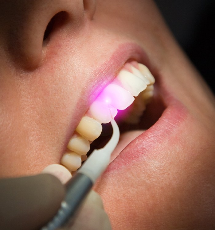 Patient receiving laser dentistry treatment