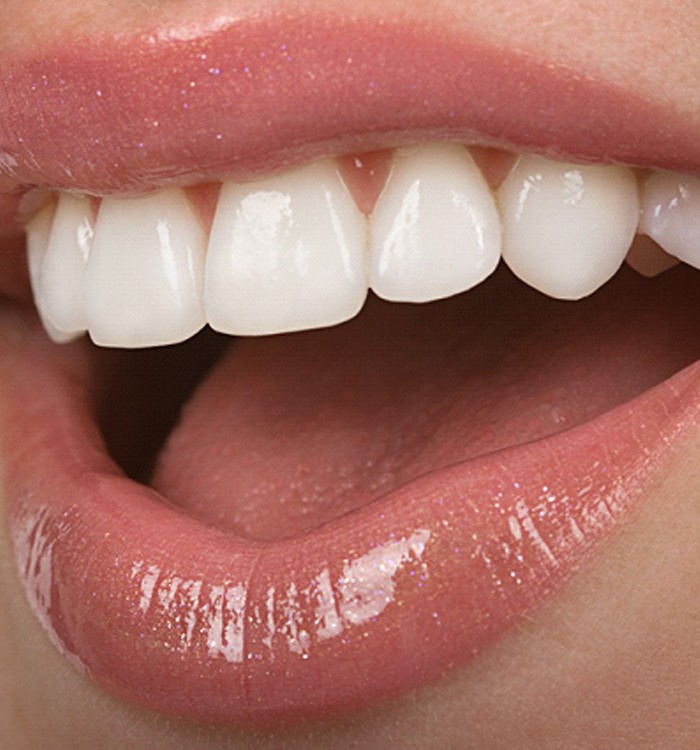 Close-up of woman’s smile with glossy lips and veneers